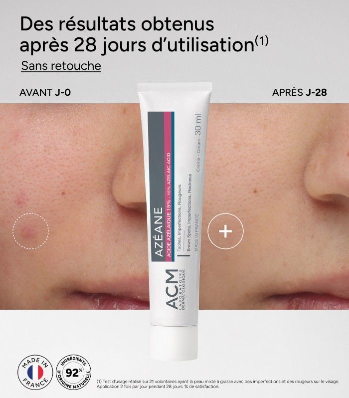 AZÉANE CRÈME - ACIDE AZÉLAÏQUE 15%
