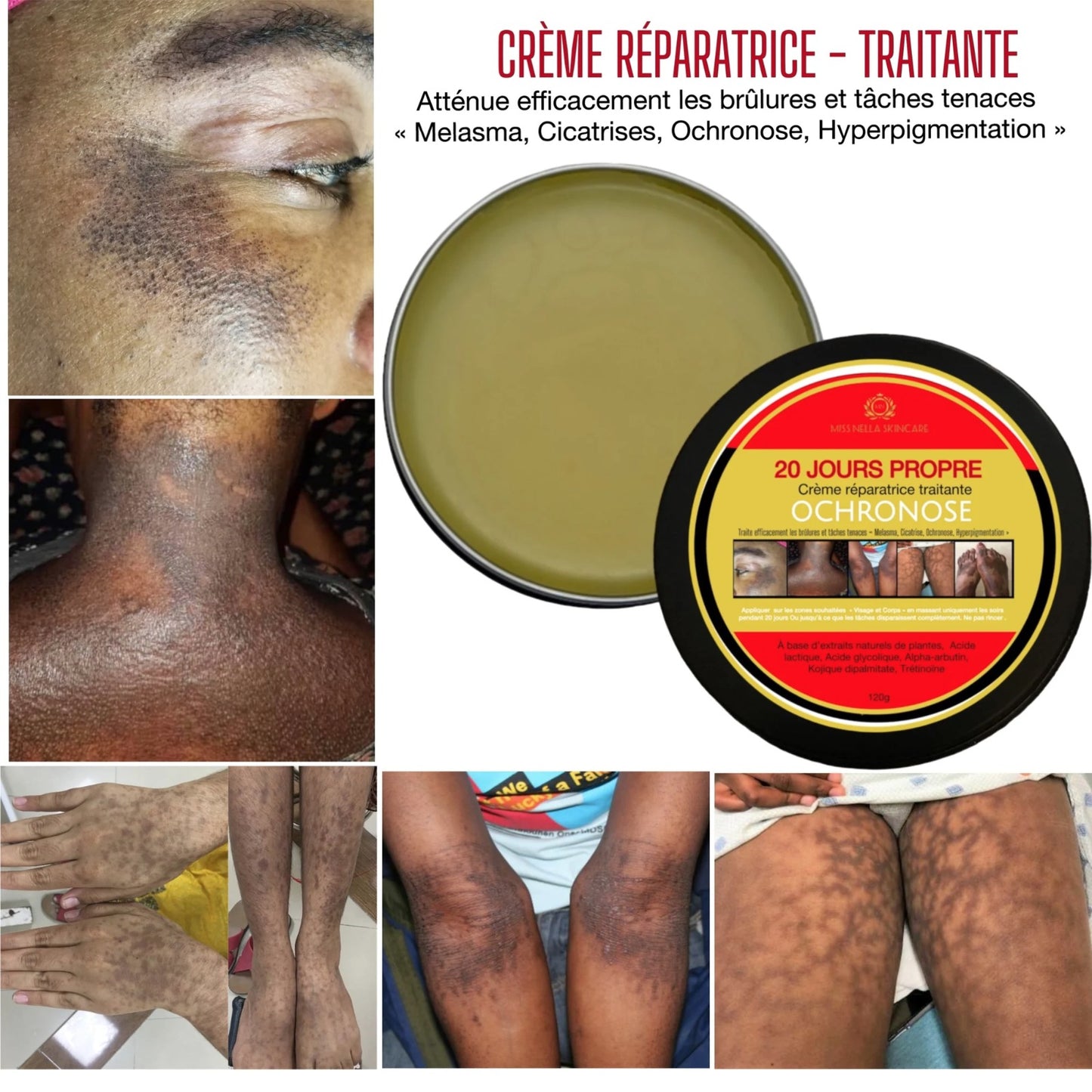 CREME HARMONY TRAITEMENT DES TACHES TENACES / CRÈME RÉPARATRICE OCHRONOSE