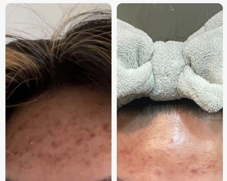Topicals Mini Faded Serum 15ml for Dark Spots & Discoloration Faded topicals sérum crèmeux super anti imperfection