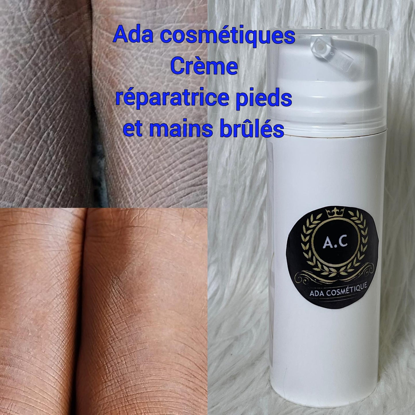 CRÈME MIRACLE ULTRA ÉCLAIRCISSANTE ANTI IMPERFECTION MELASMA TACHES PHALANGES ET PIE VIVE L'ÉTÉ