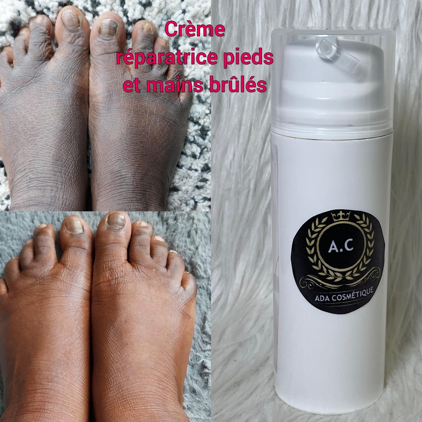 CRÈME MIRACLE ULTRA ÉCLAIRCISSANTE ANTI IMPERFECTION MELASMA TACHES PHALANGES ET PIE VIVE L'ÉTÉ